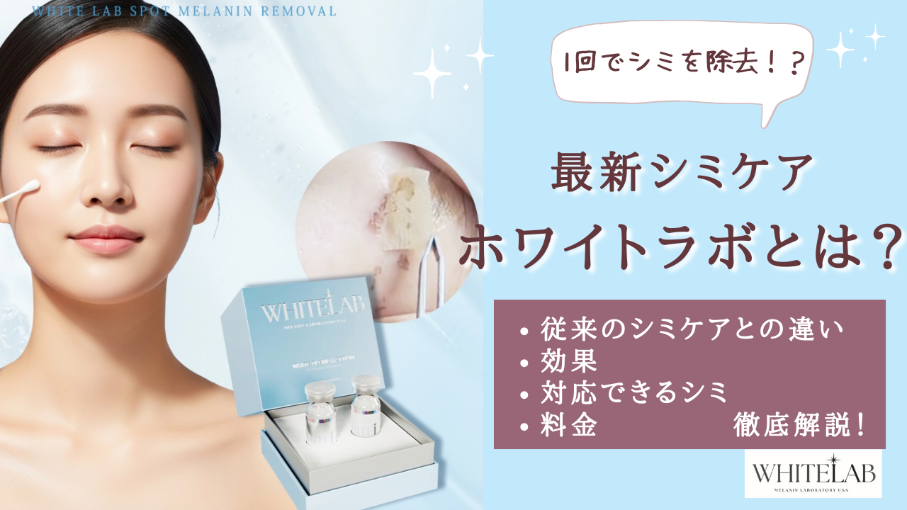 ホワイトラボ（WHITE LAB）のシミ取りとは？1回で変化を実感！最新 